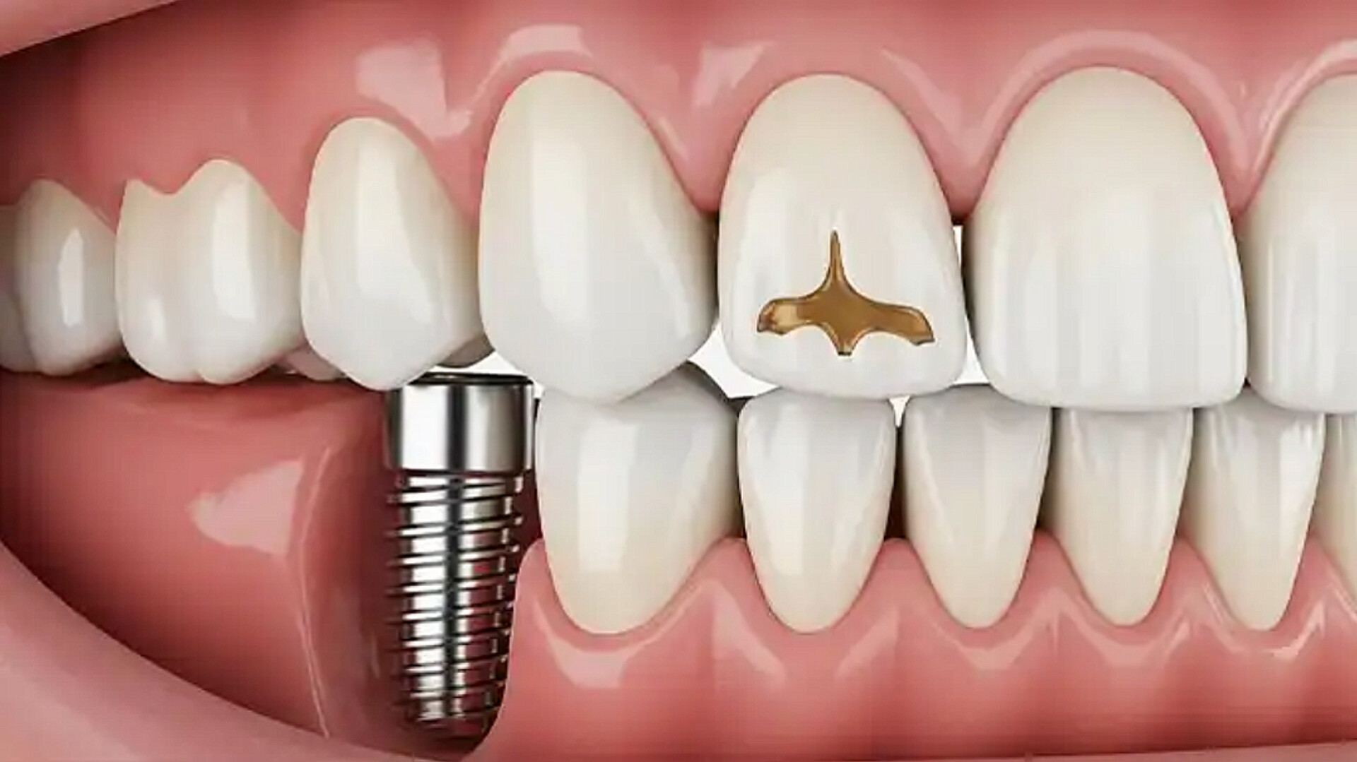 دندانپزشکی تهرانپارس