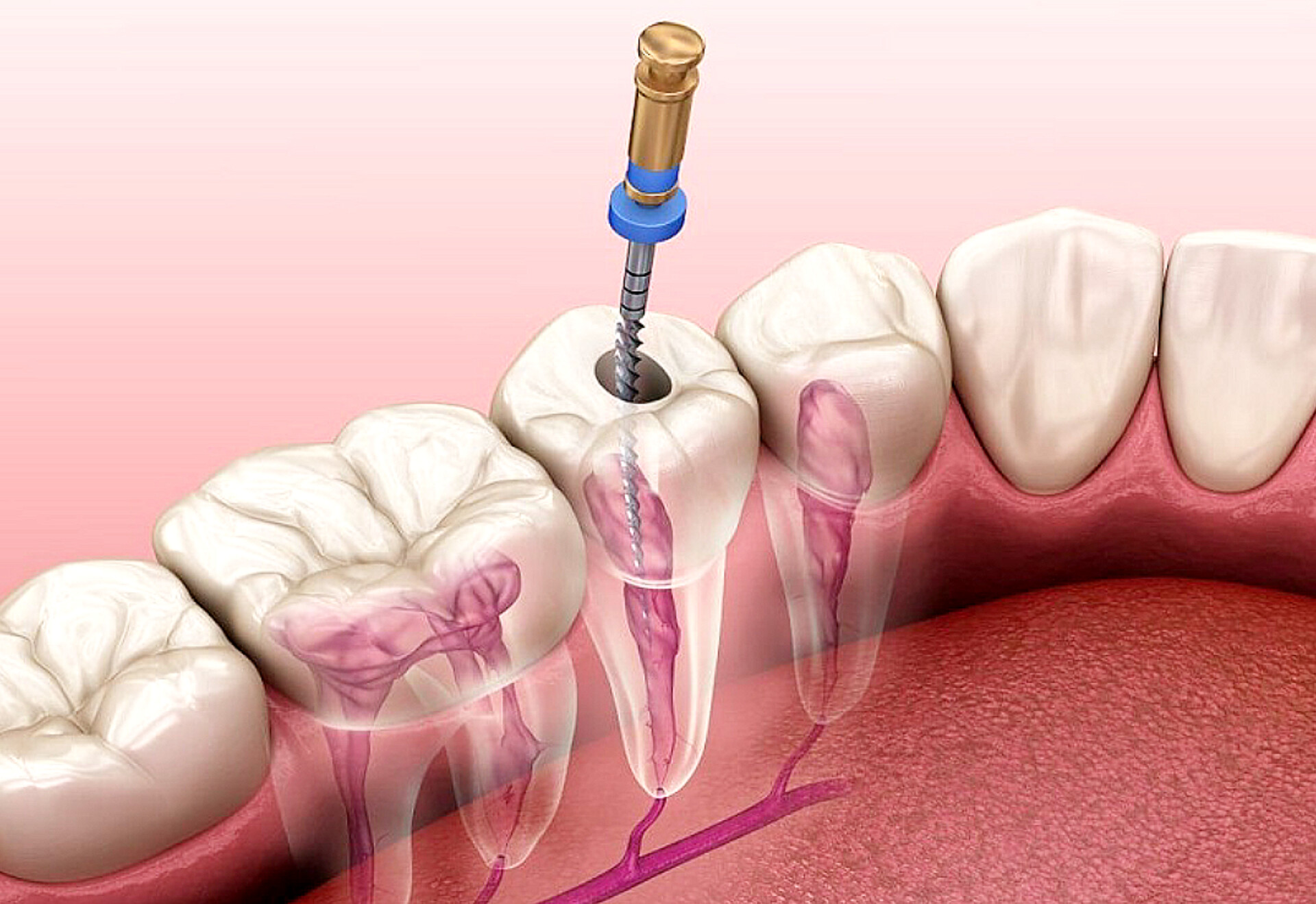دندانپزشکی تهرانپارس