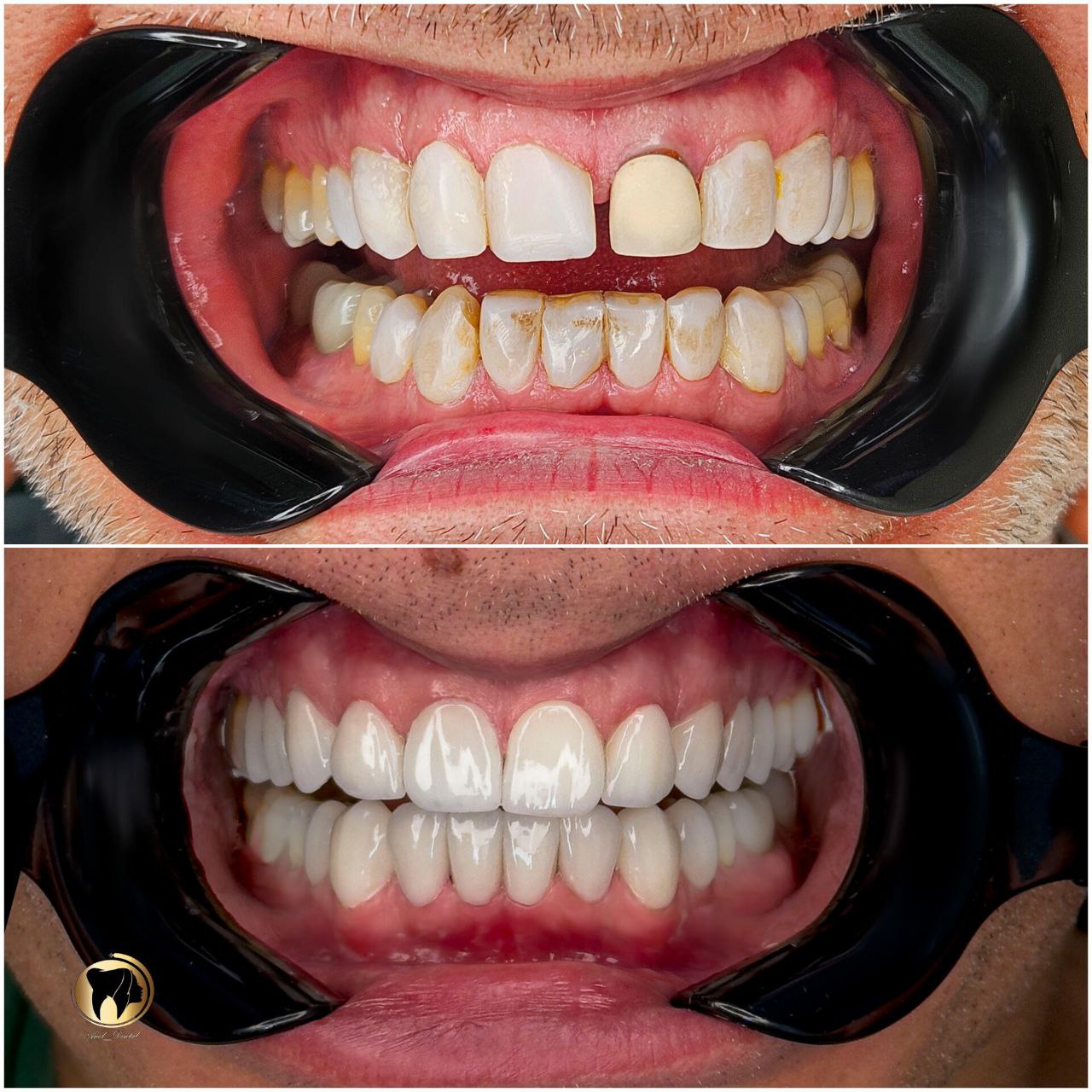 COSMETIC DENTISTRY CLINIC IN TEHRAN