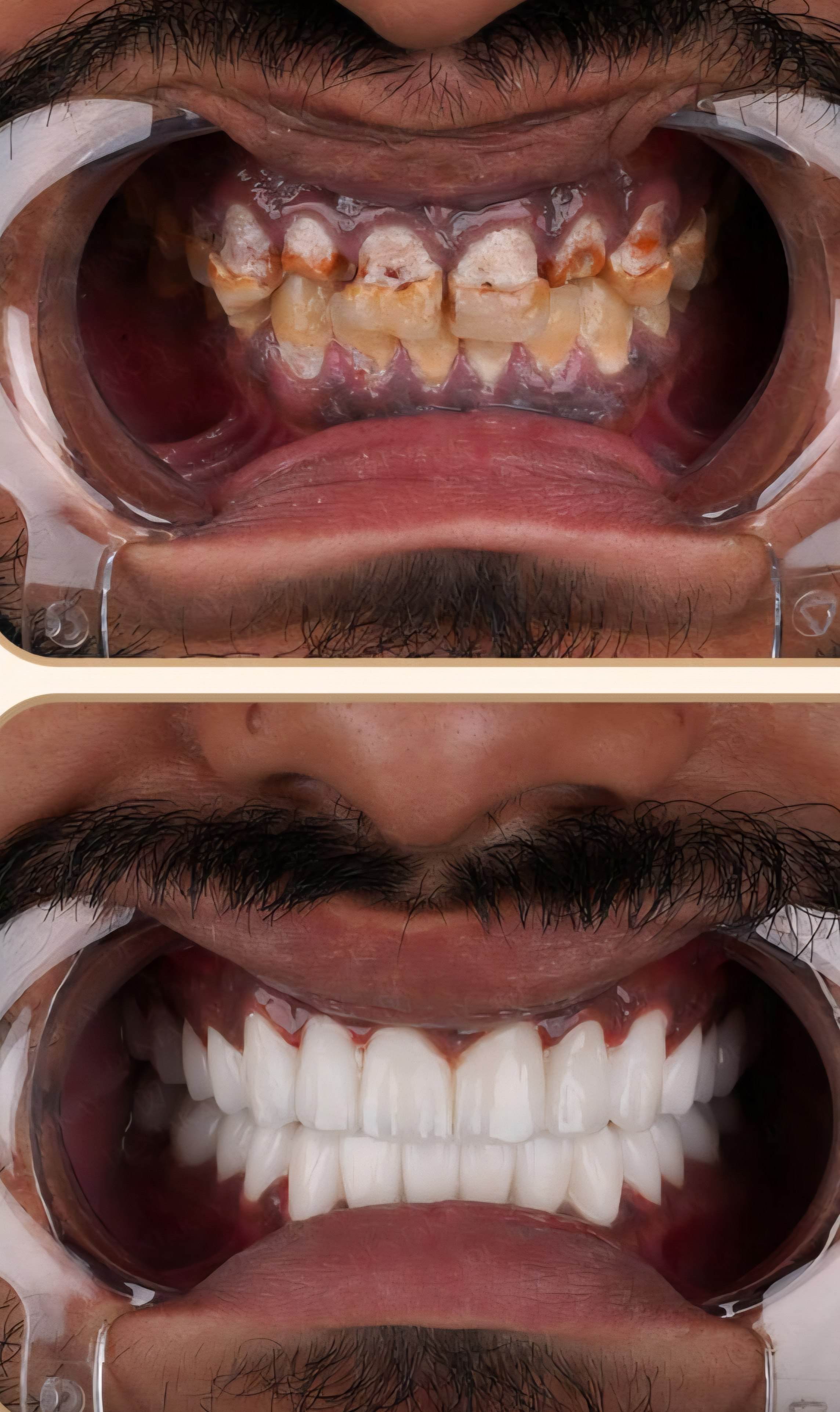 COSMETIC DENTISTRY CLINIC IN TEHRAN