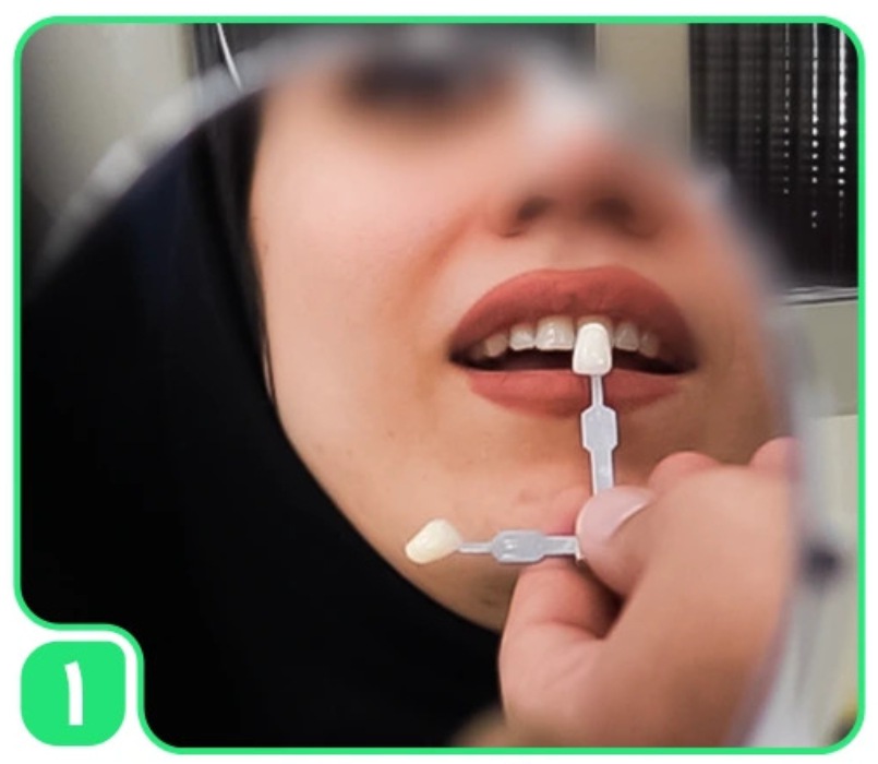 عيادة آنِل لطب األسنان التجميلي في طهران