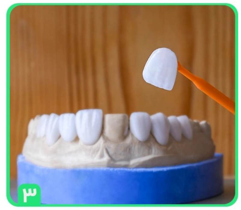 عيادة آنِل لطب األسنان التجميلي في طهران