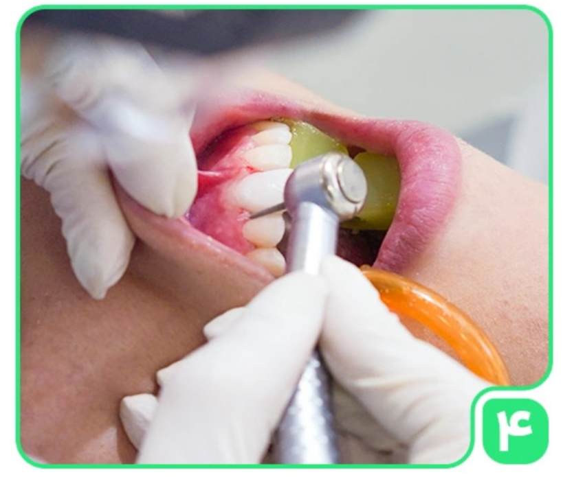 عيادة آنِل لطب األسنان التجميلي في طهران