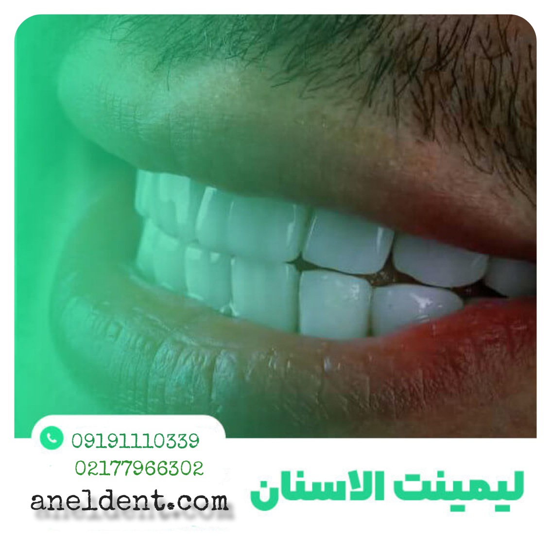 عيادة آنِل لطب األسنان التجميلي في طهران