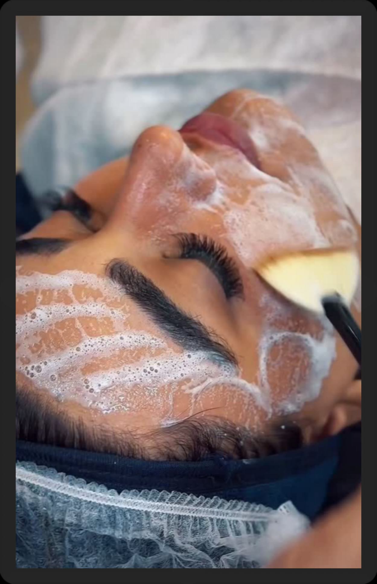 بهترین مرکز فیشیال پوست در شیراز