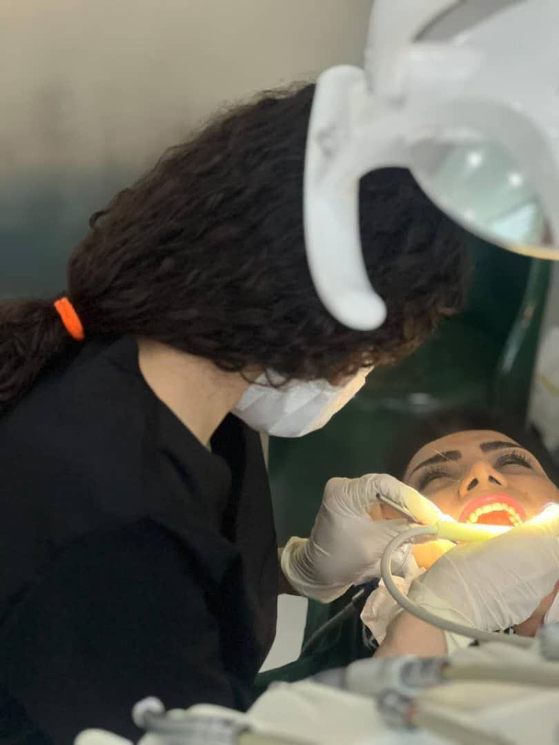 جرم گیری دندان در کرج