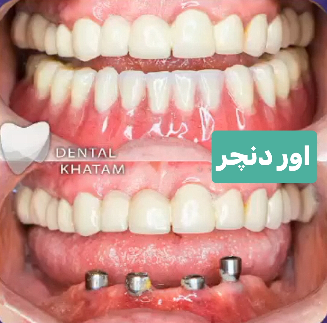 کلینیک دندانپزشکی خاتم