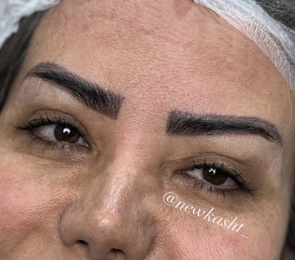 کاشت ابرو در آمل
