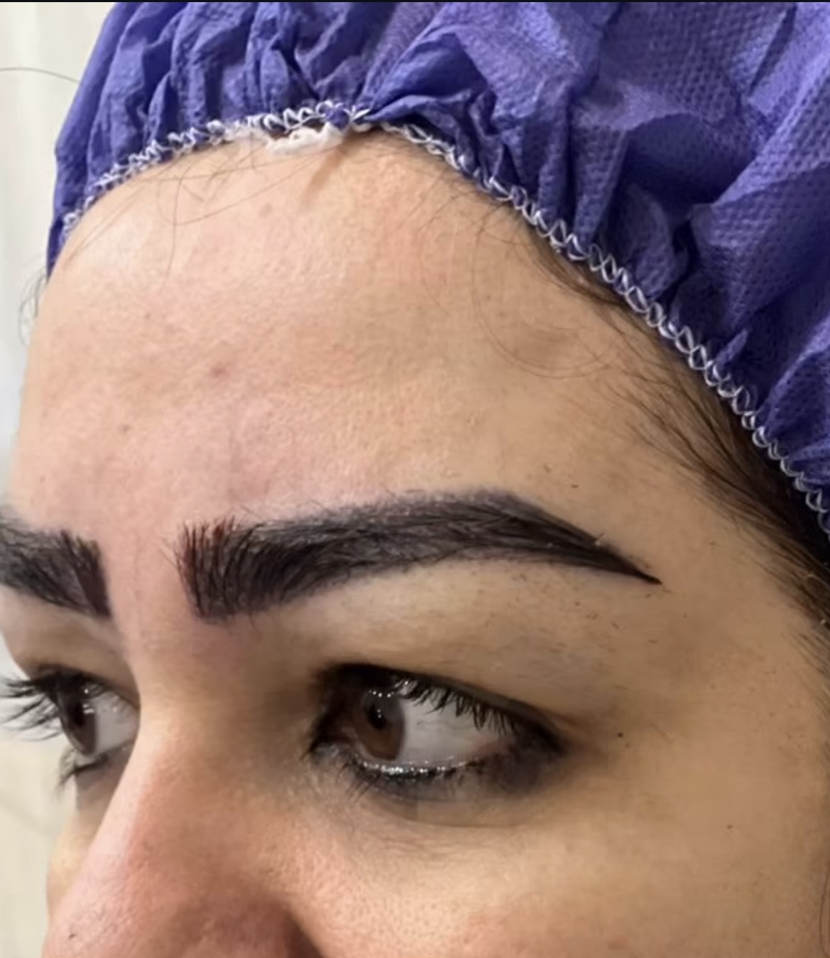 کاشت ابرو در آمل
