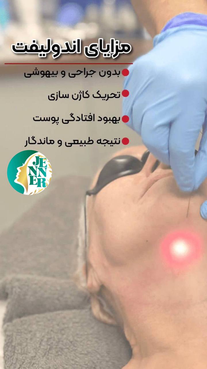 لیپوساکشن در کرج