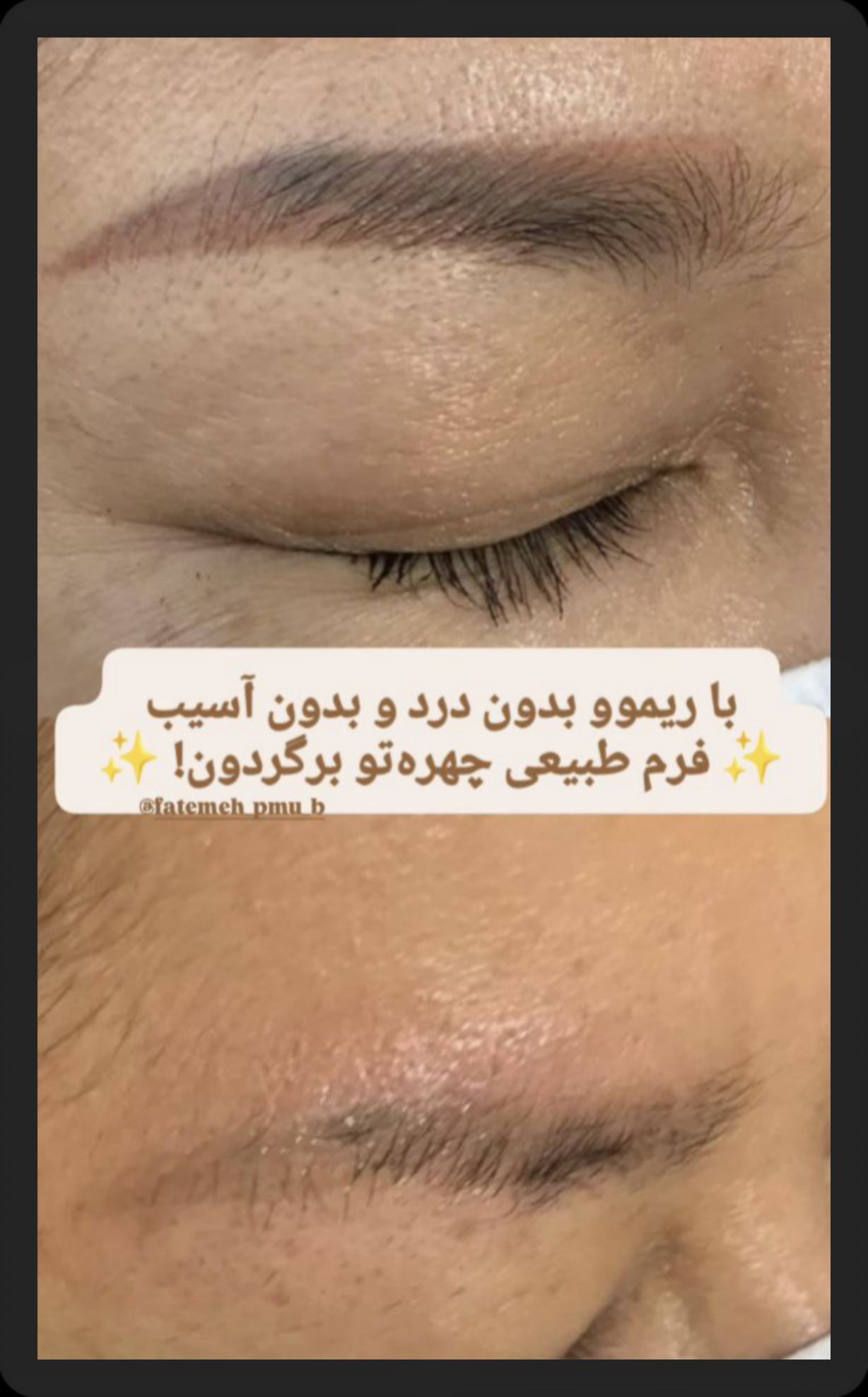 بهترین مرکز آرایش دائم در شیراز