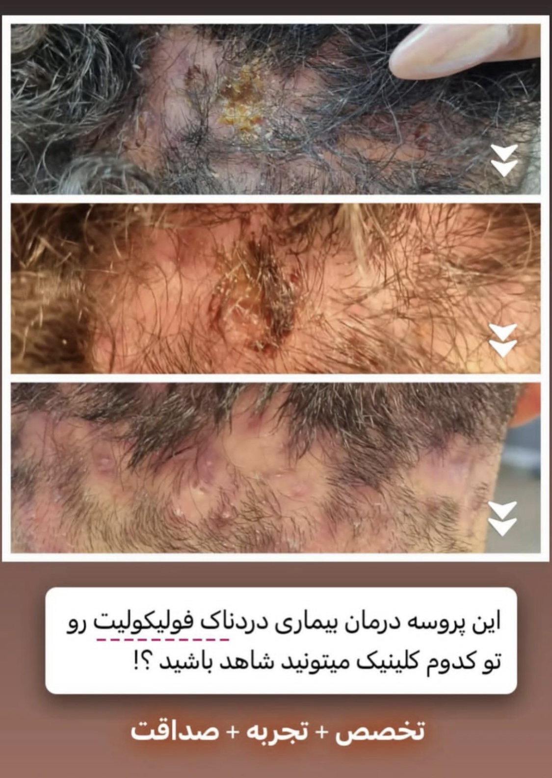 اولين مركز درمان مو و پوست در تهران ايران