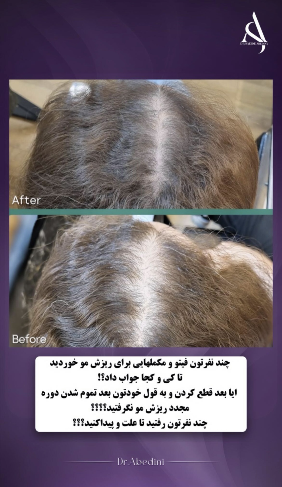 اولين مركز درمان مو و پوست در تهران ايران