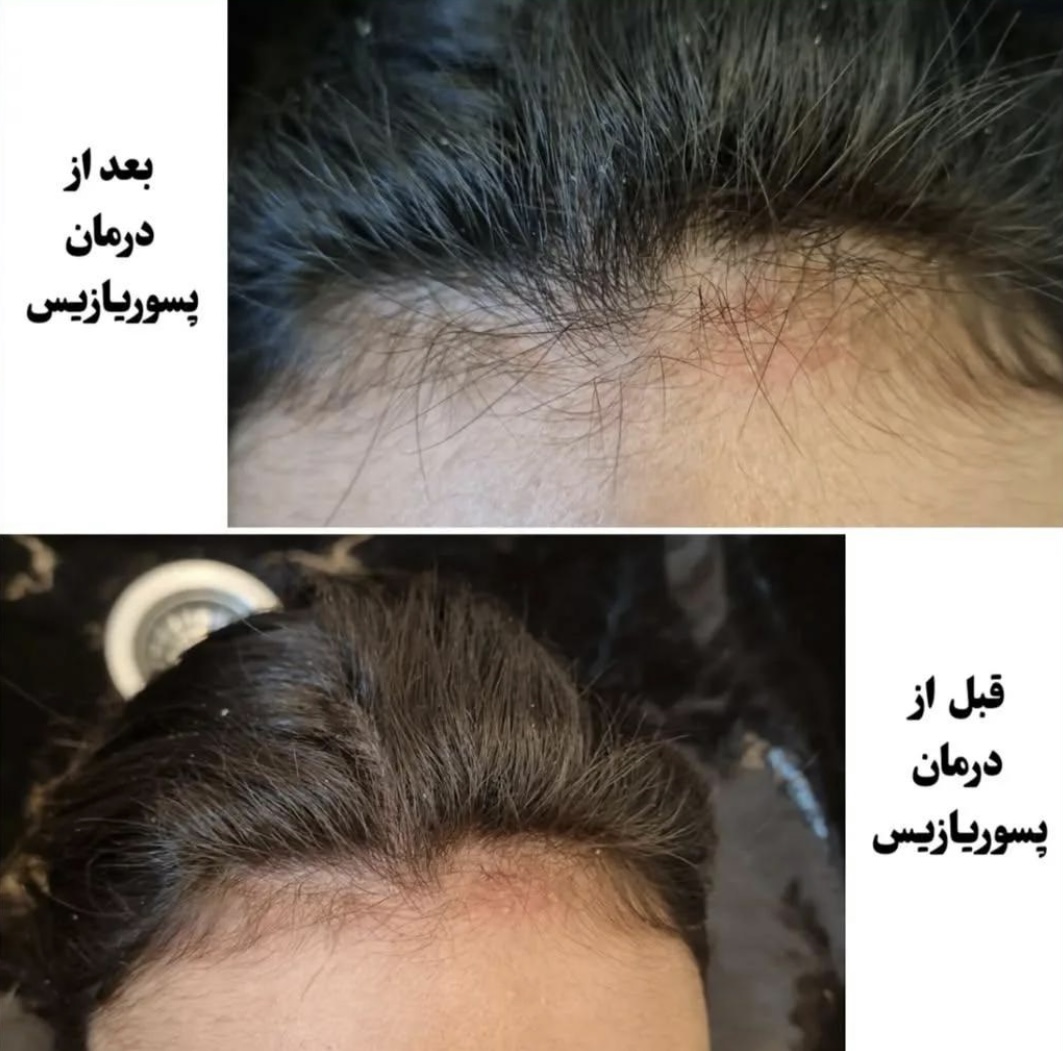 اولين مركز درمان مو و پوست در تهران ايران