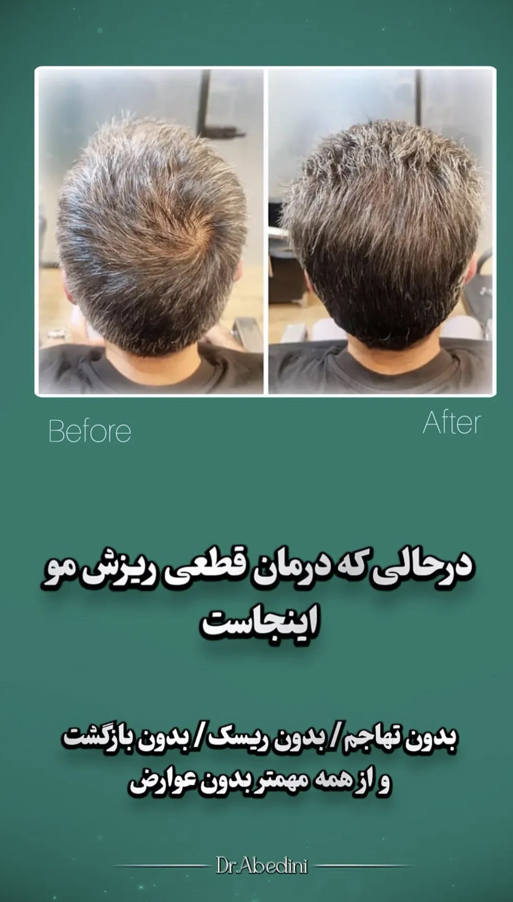 اولين مركز درمان مو و پوست در تهران ايران