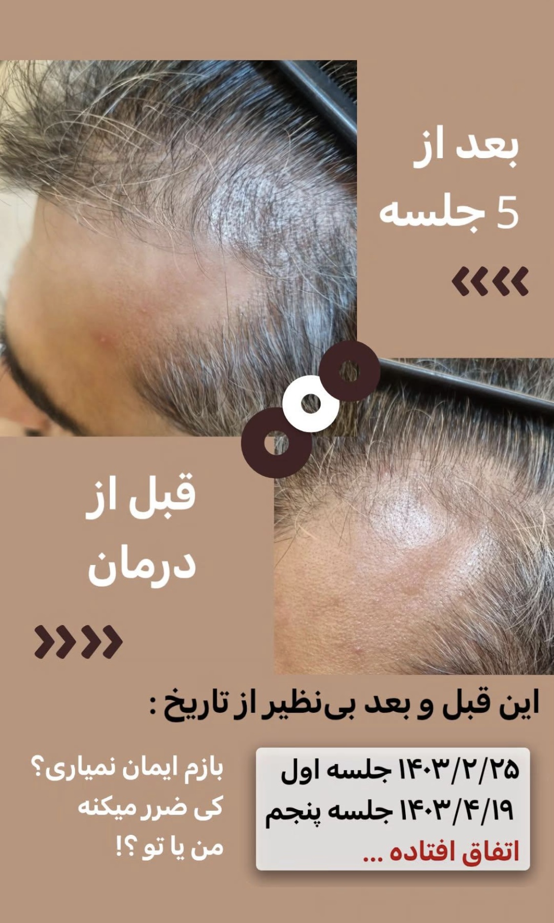 اولين مركز درمان مو و پوست در تهران ايران