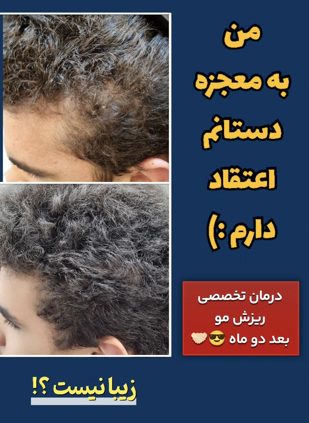 بهترين مركز درمان مو و پوست در غرب تهران