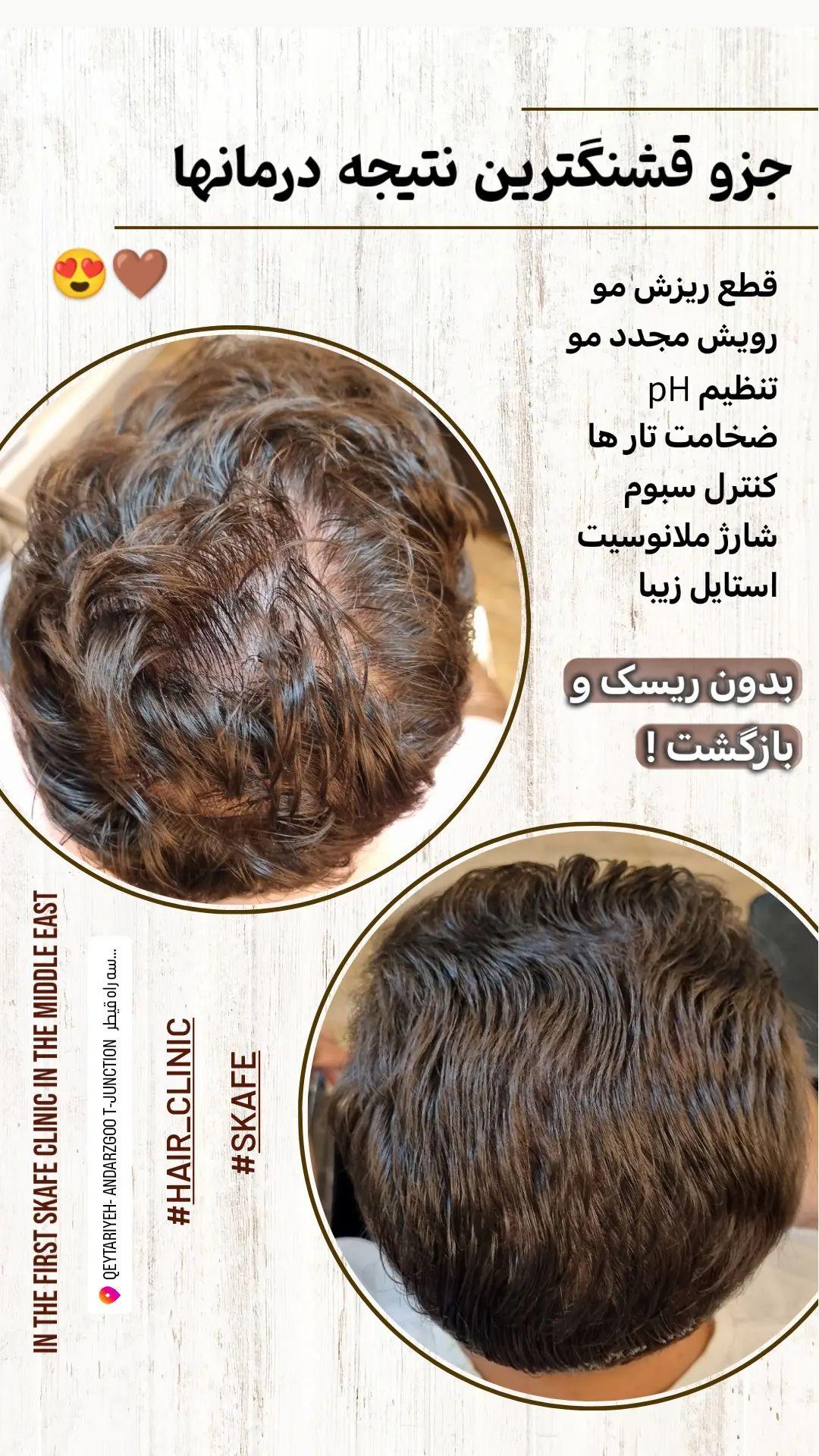 اولين مركز تخصصى پوست و مو در تهران ايران
