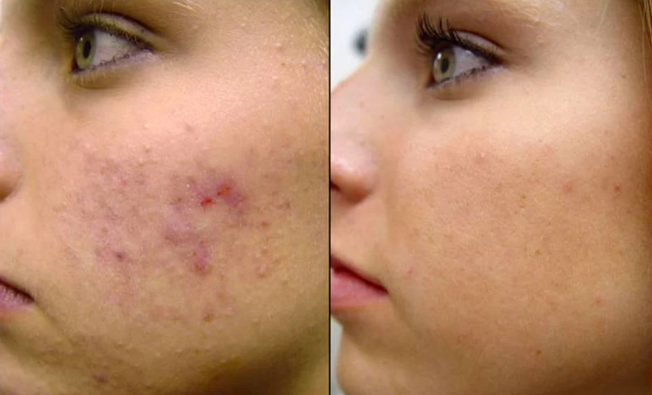 بهترین مرکز فیشال در پردیس&nbsp;