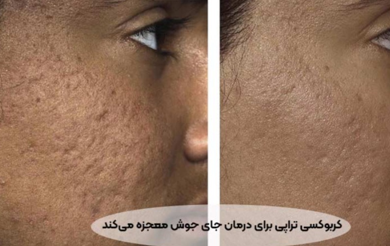 بهترین مرکز فیشال در پردیس&nbsp;