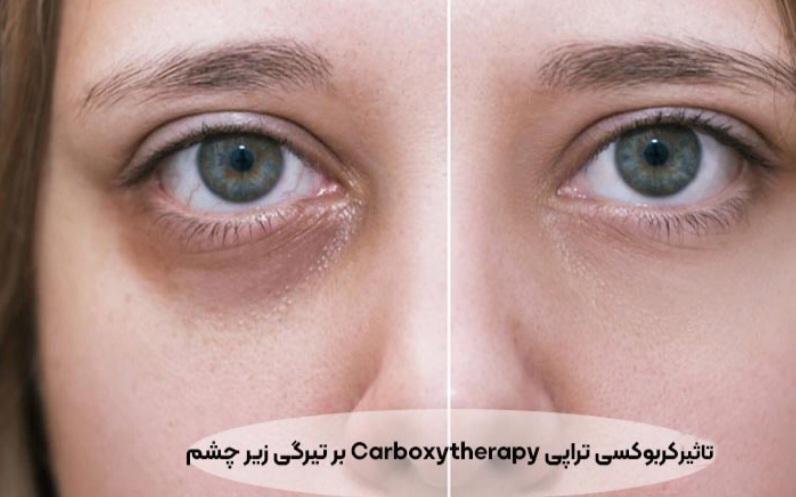 بهترین مرکز فیشال در پردیس&nbsp;