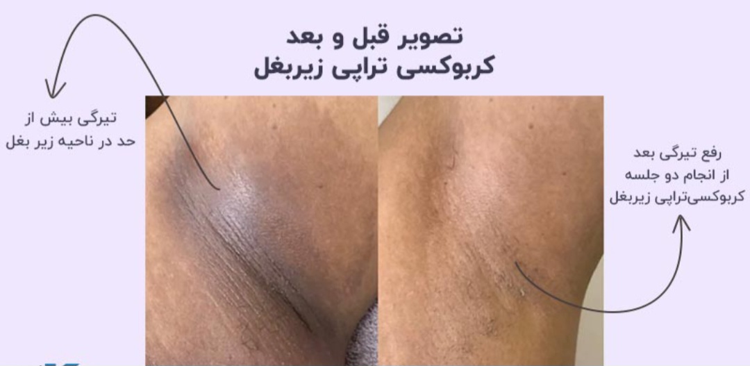 بهترین مرکز فیشال در پردیس&nbsp;