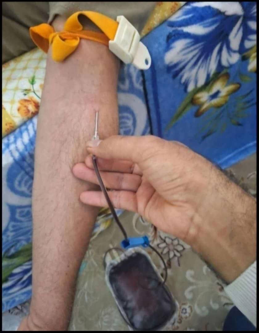 فصد اورژانسی