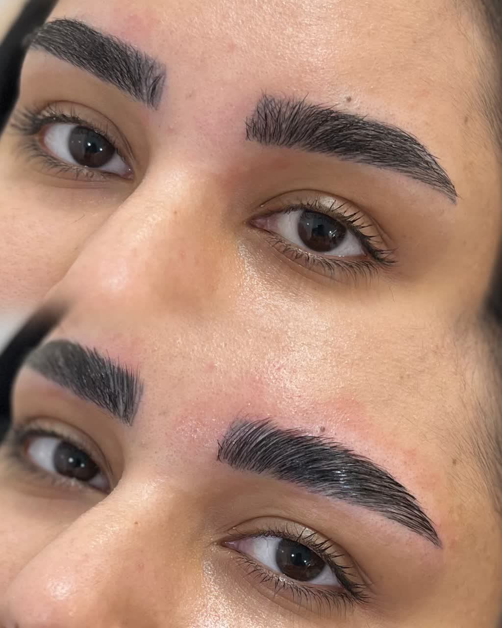 نمونه کار لیفت ابرو 6