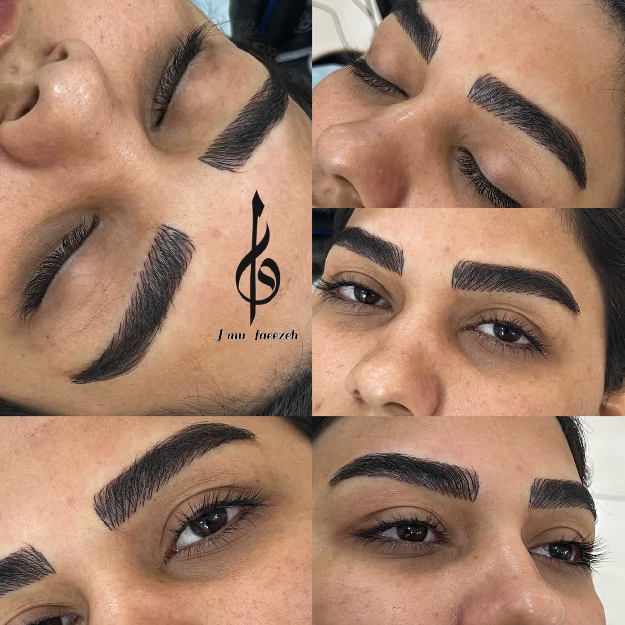 نمونه فیبروز 2