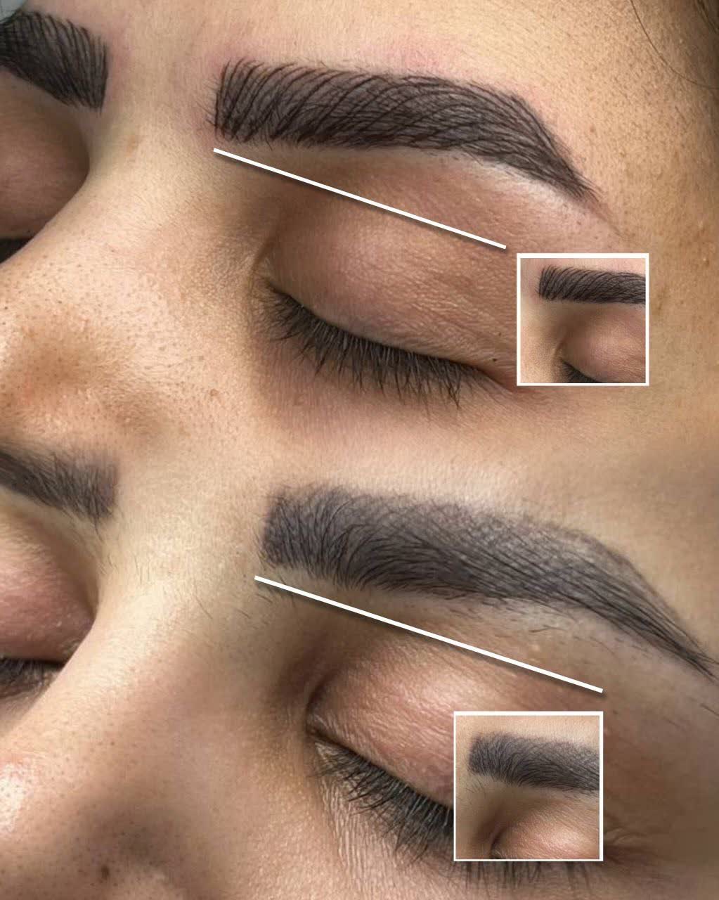 نمونه فیبروز 5
