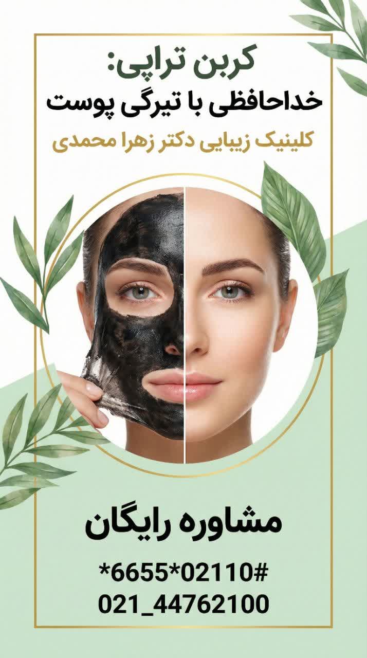 کربن تراپی و رفع تیرگی پوست در چیتگر