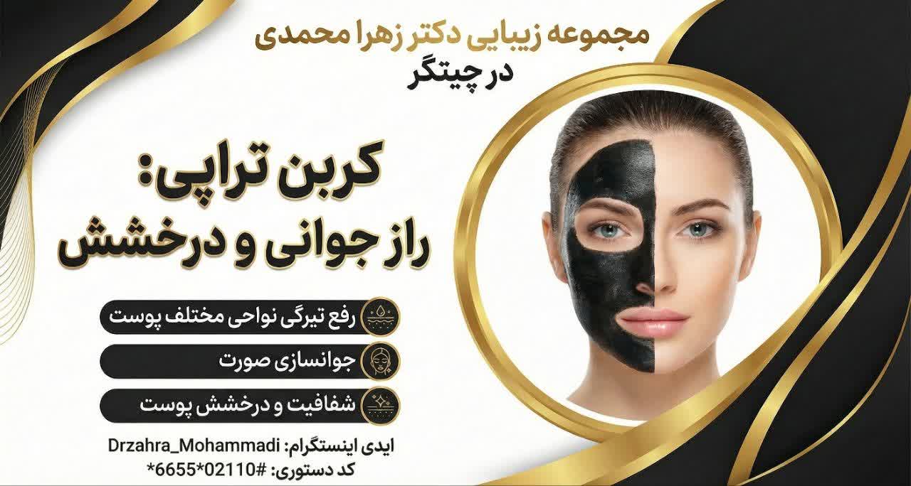 کربن تراپی در چیتگر تهران