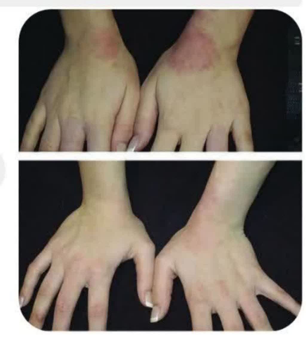 طب سنتی در بروجرد