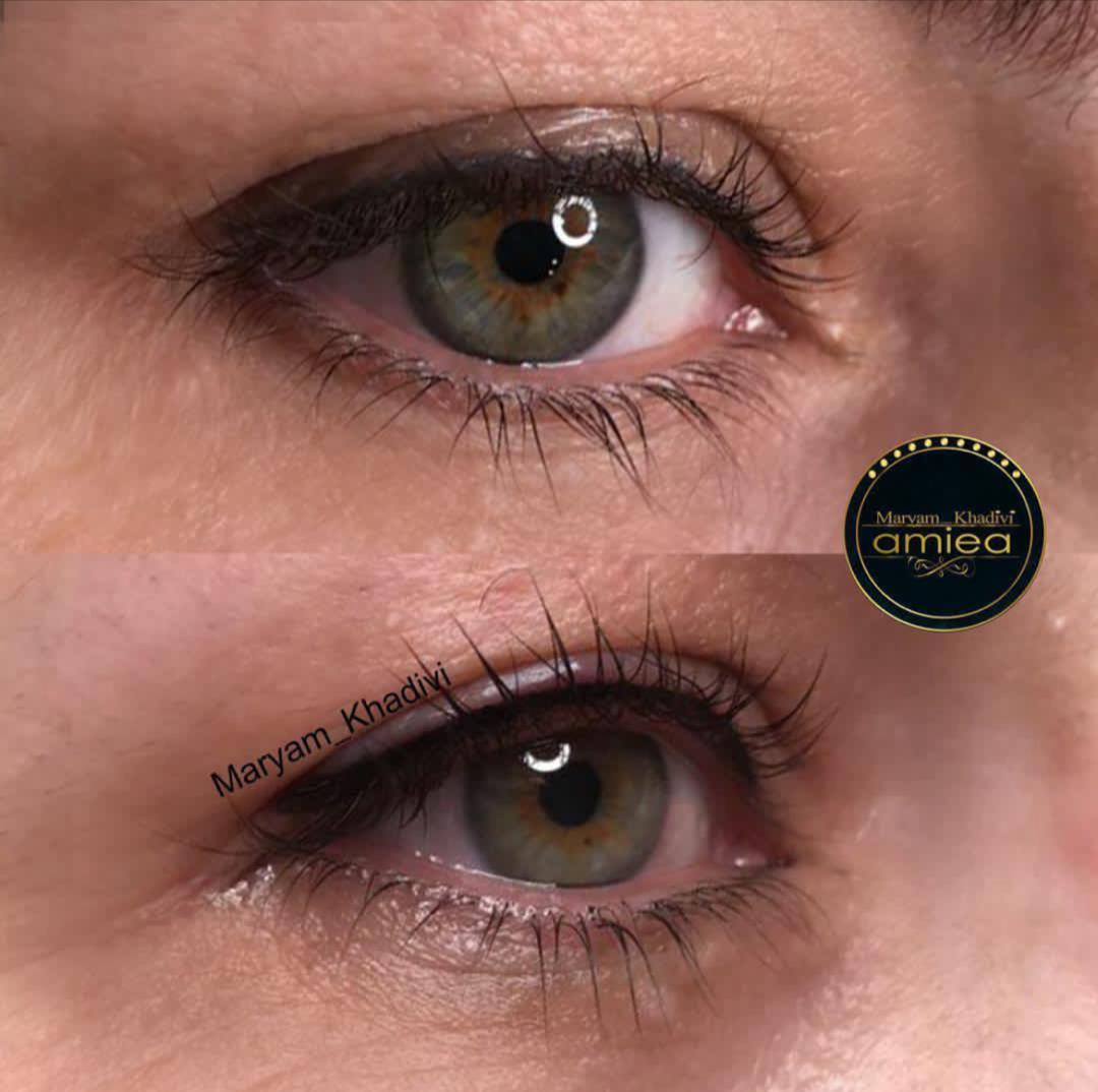 مزایا میکرو