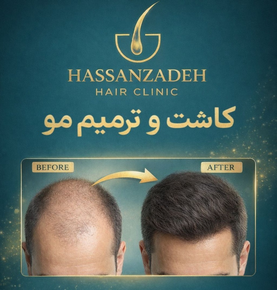 دکتر حسن زاده