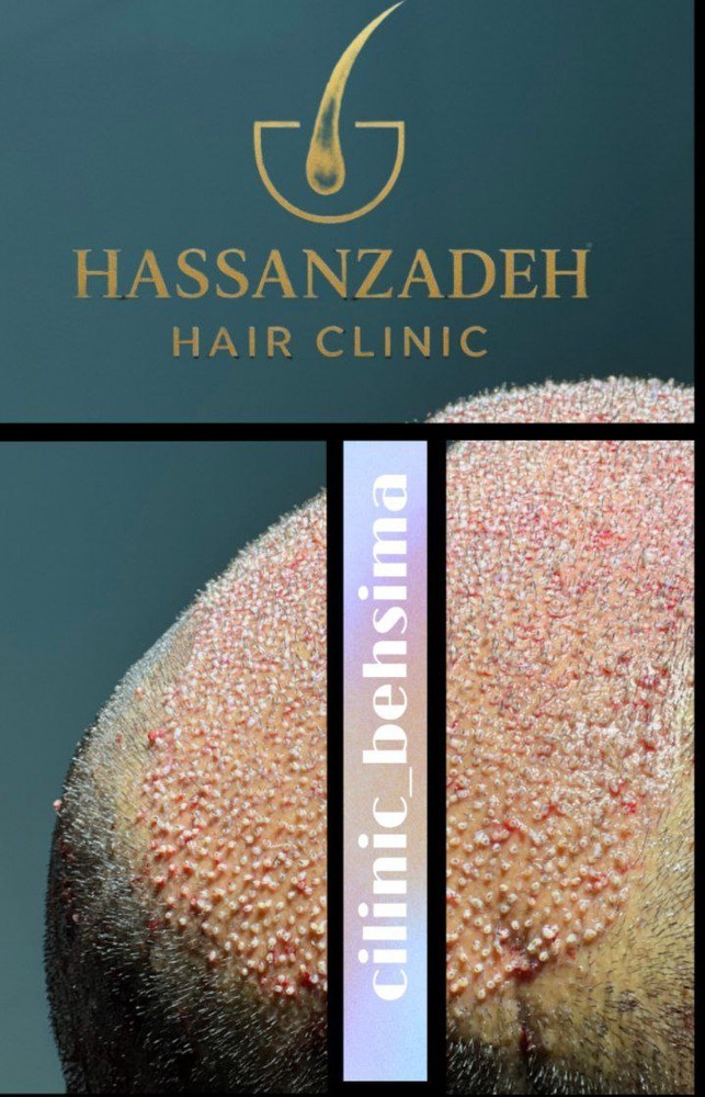 دکتر حسن زاده