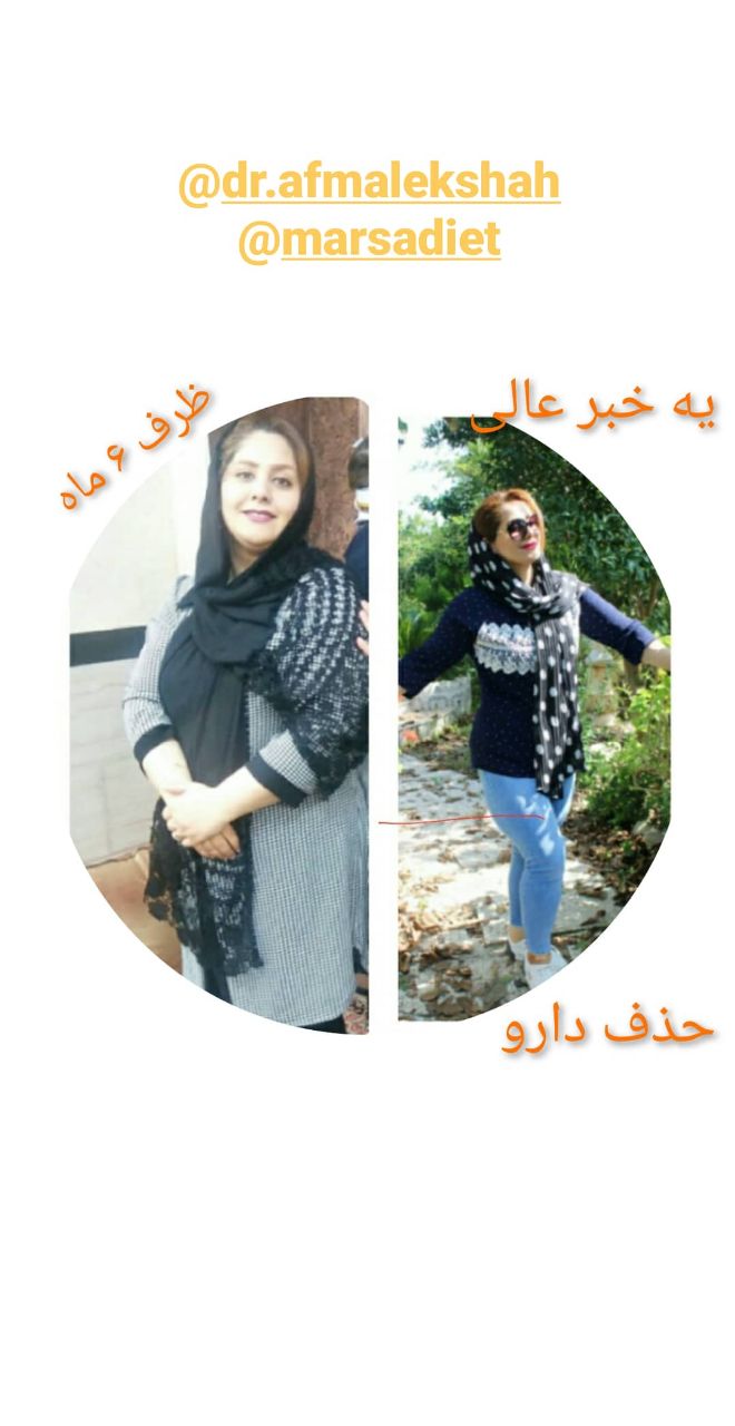 رژیم لاغری در ساری