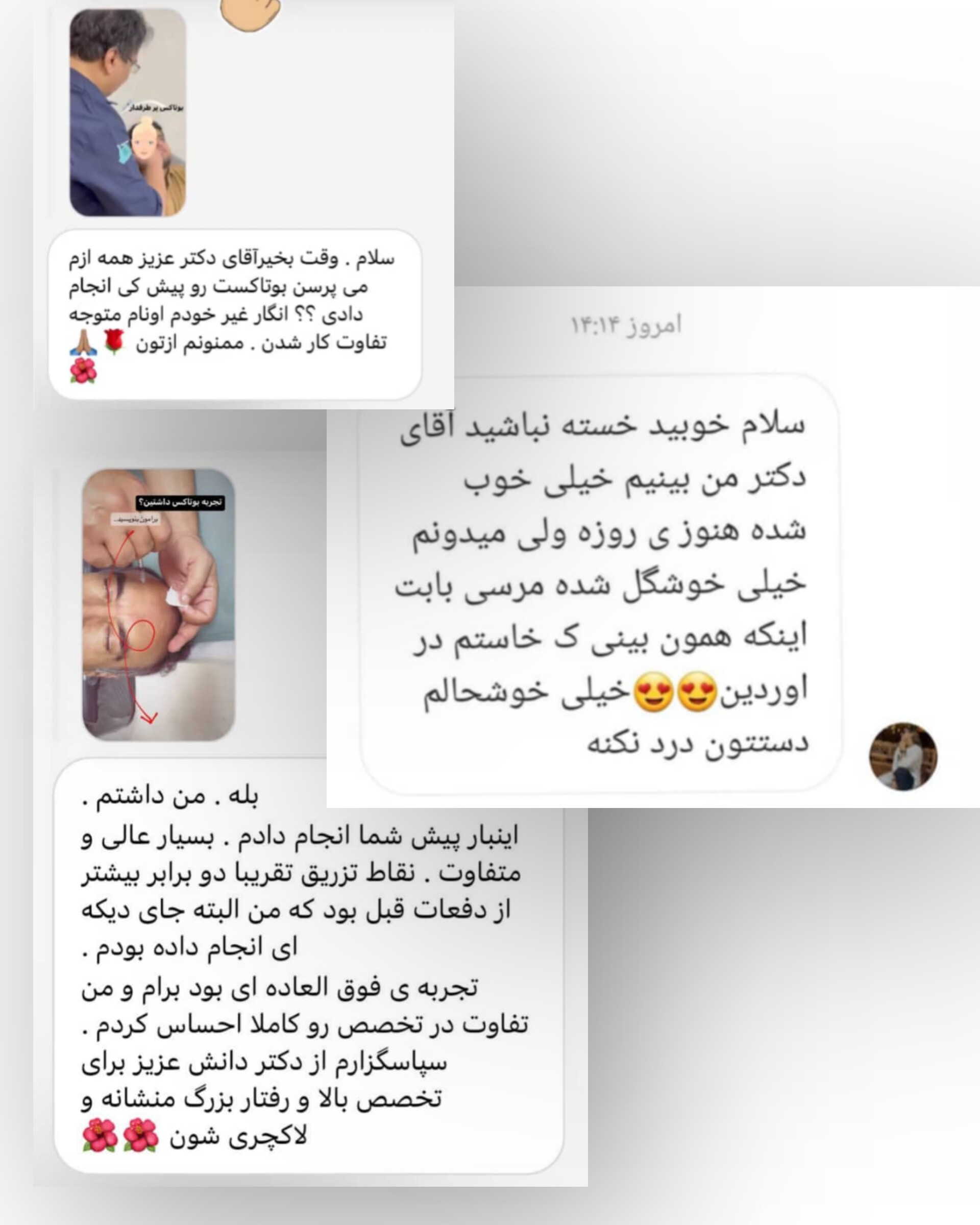 رینوپلاستی در شهر زاهدان