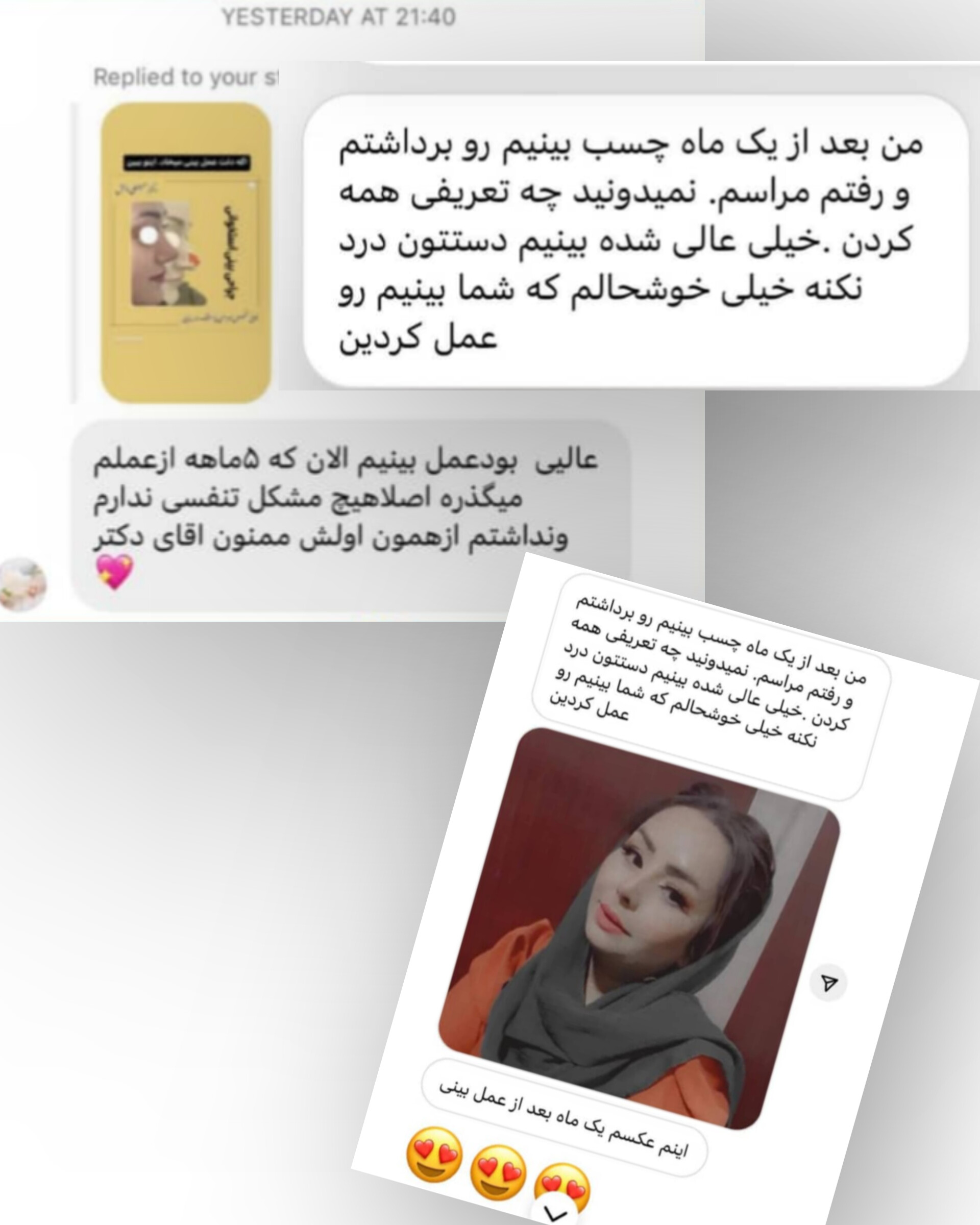 رینوپلاستی در شهر زاهدان
