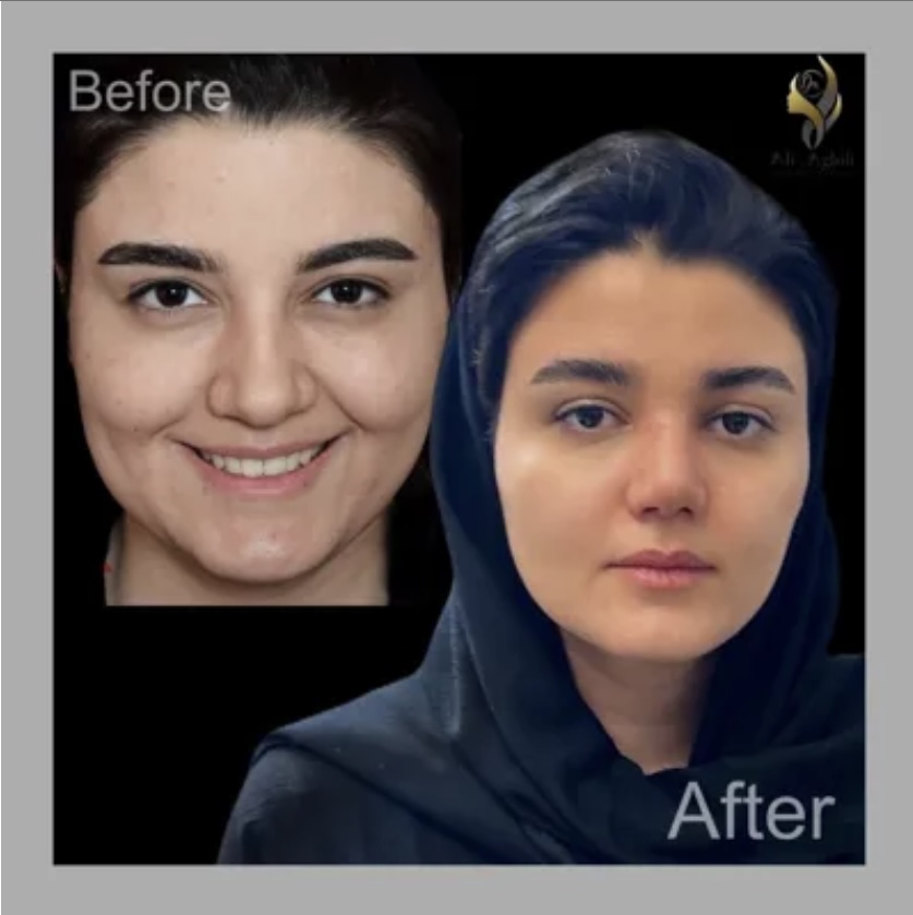 متخصص بینی در تهران
