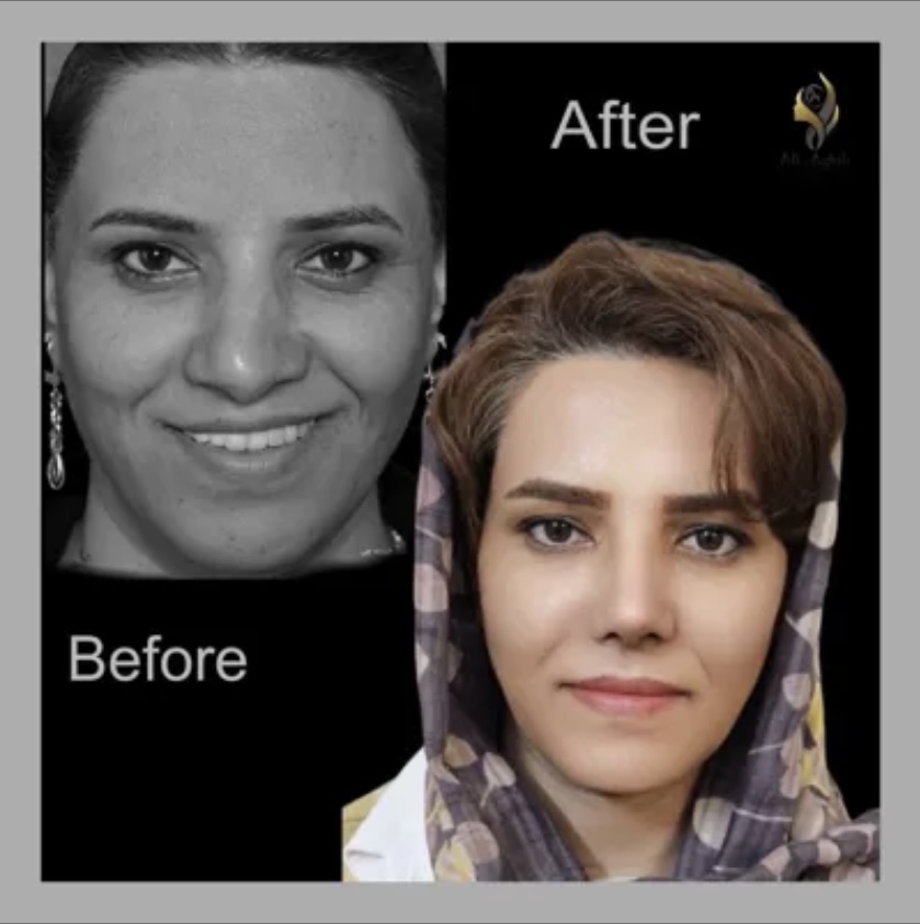 متخصص بینی در تهران