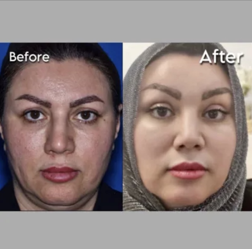 متخصص بینی در تهران