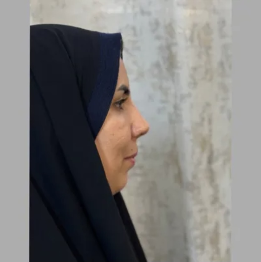 متخصص بینی در تهران