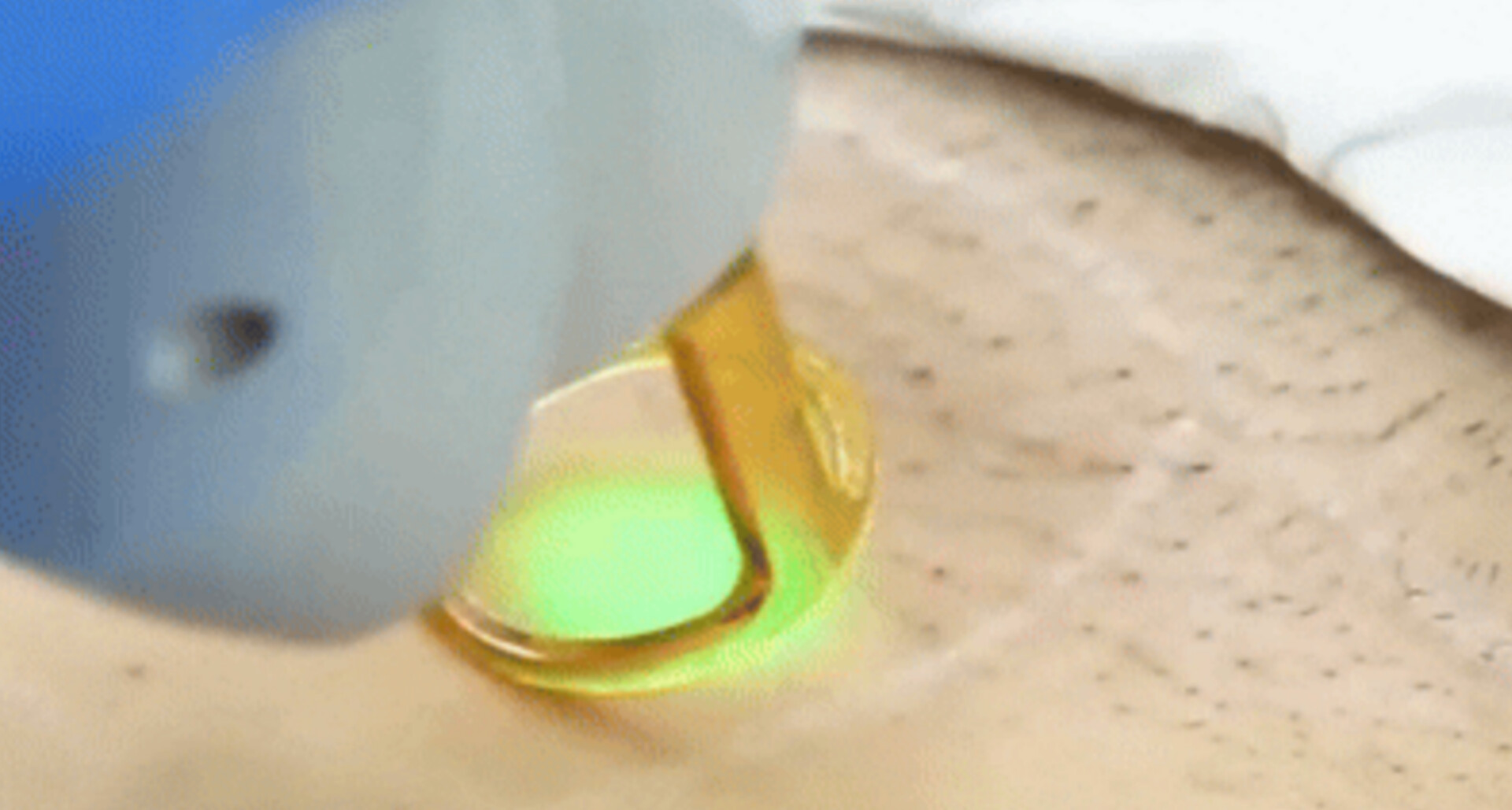 لیزر خانم ها در زاهدان