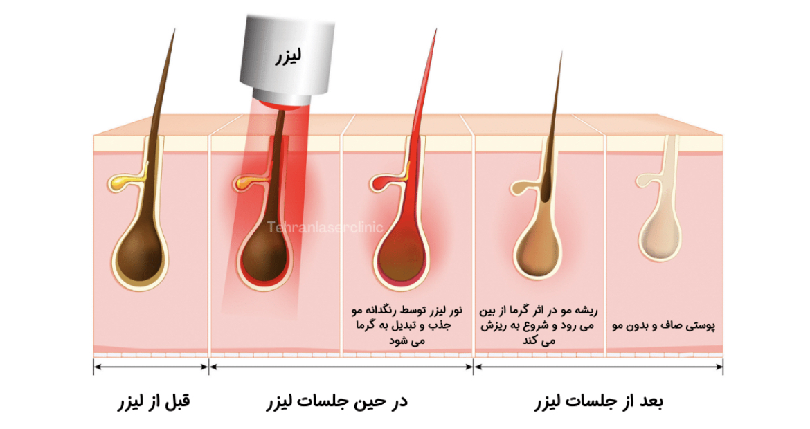مرکز لیزر در بروجرد