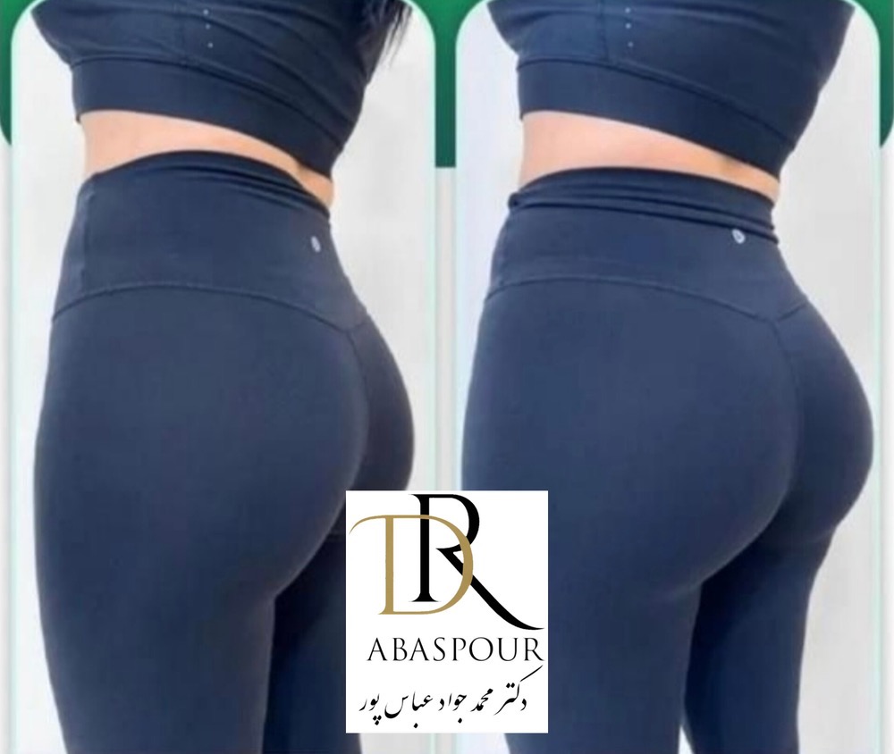 تزریق ژل و بوتاکس در اصفهان