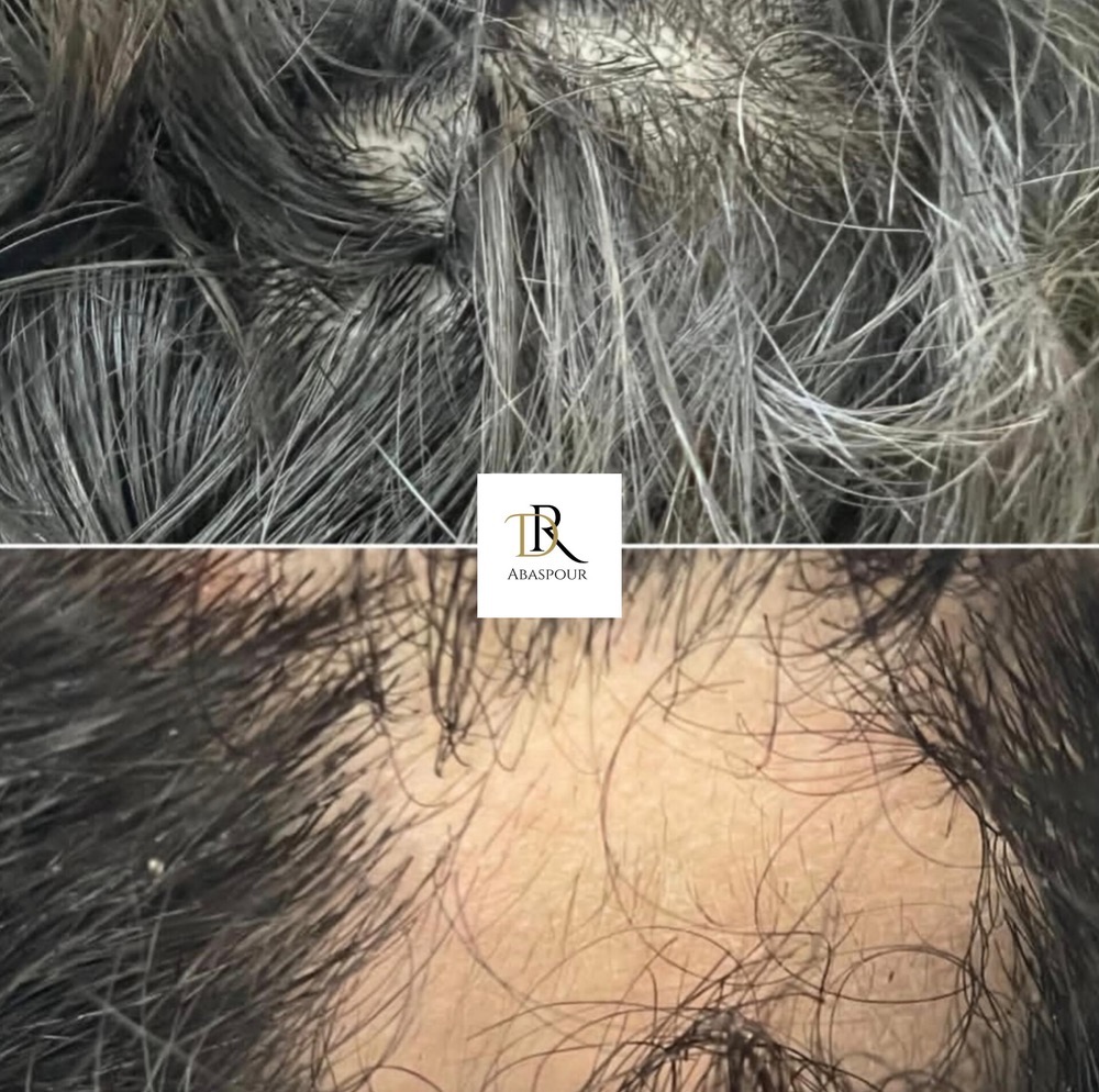 تزریق ژل و بوتاکس در اصفهان