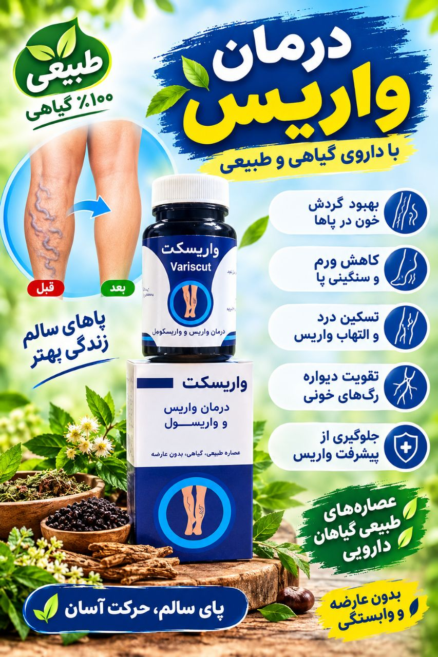 درمان واریس با داروی طبیعی