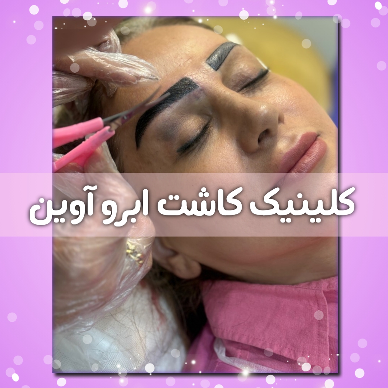 مرکز کاشت ابرو در کرج