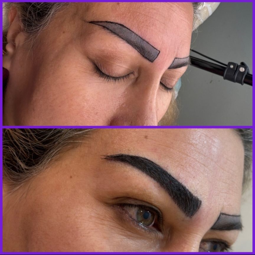 مرکز کاشت ابرو در کرج
